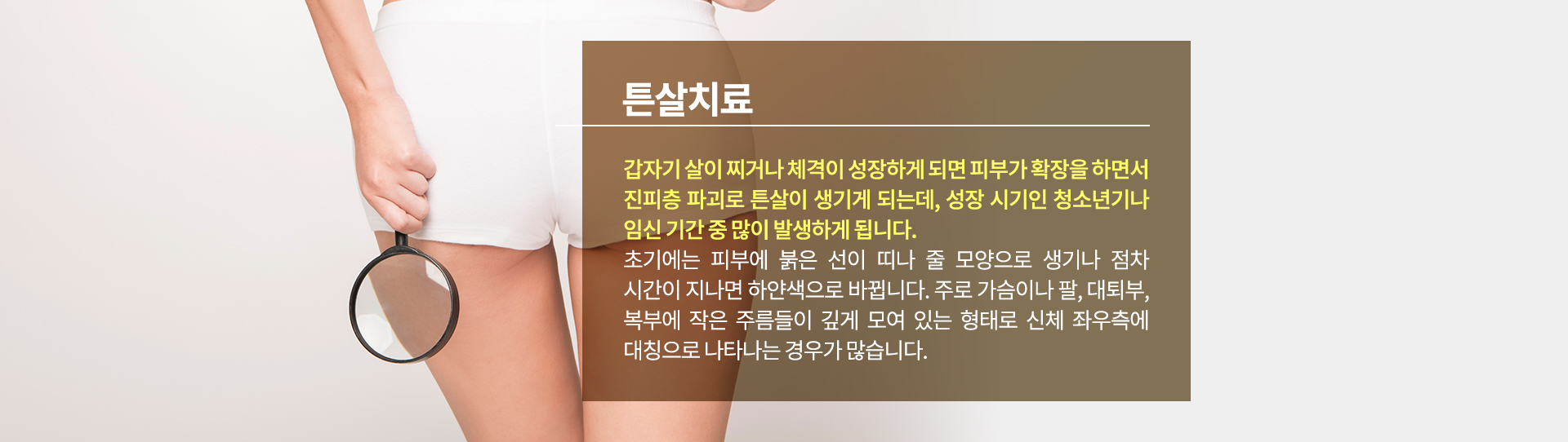 튼살치료 내용